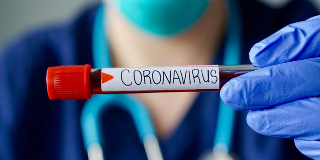 09.11.2020 Koronavirüs (COVİD-19) Tablosu